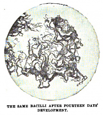 THE SAME BACILLI AFTER FOURTEEN DAYS' DEVELOPMENT.